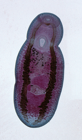 Eumetazoa