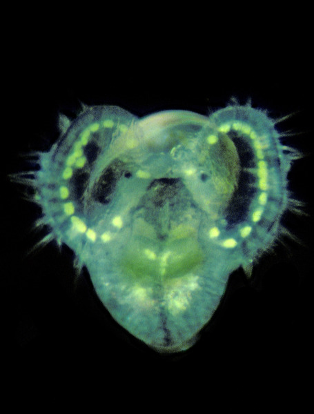 Eumetazoa