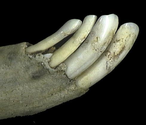 67482.liincisors_lateral