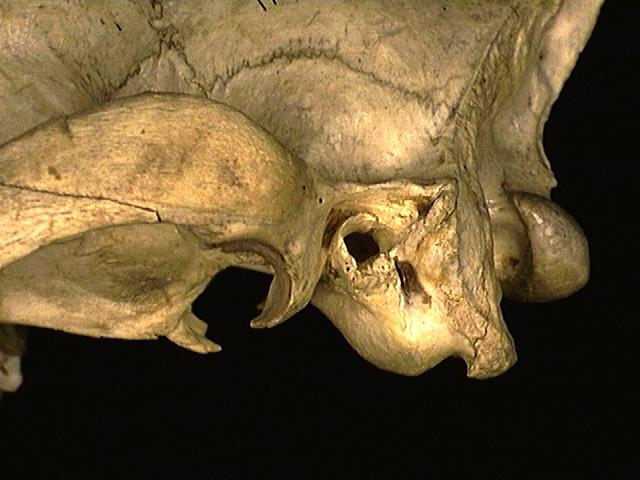 114799.paraoccipital