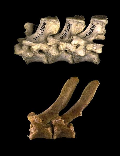 vertebrae3.composite