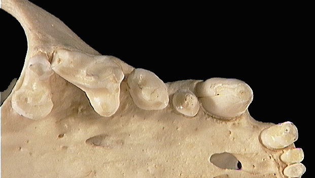 Eumetazoa