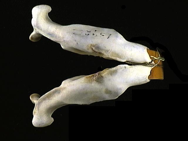 Eumetazoa