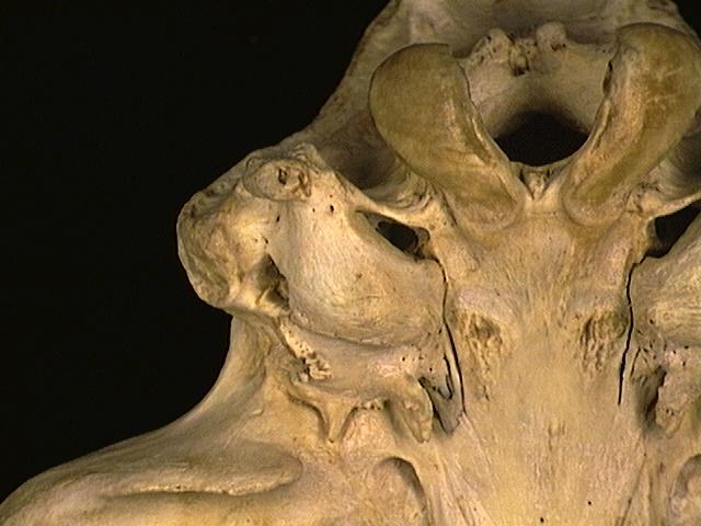 Eumetazoa