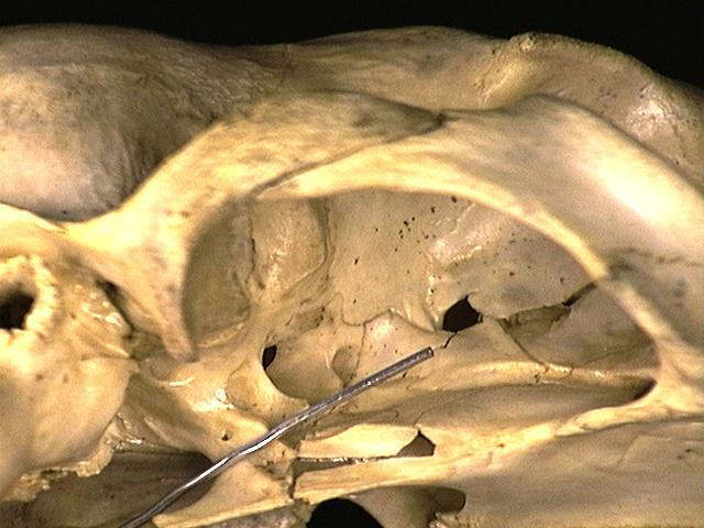 118657.alisphenoid-not